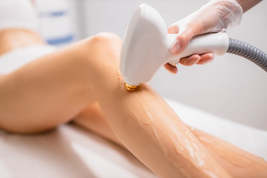 laser hair removal by Senzu Bean in Markham, ON