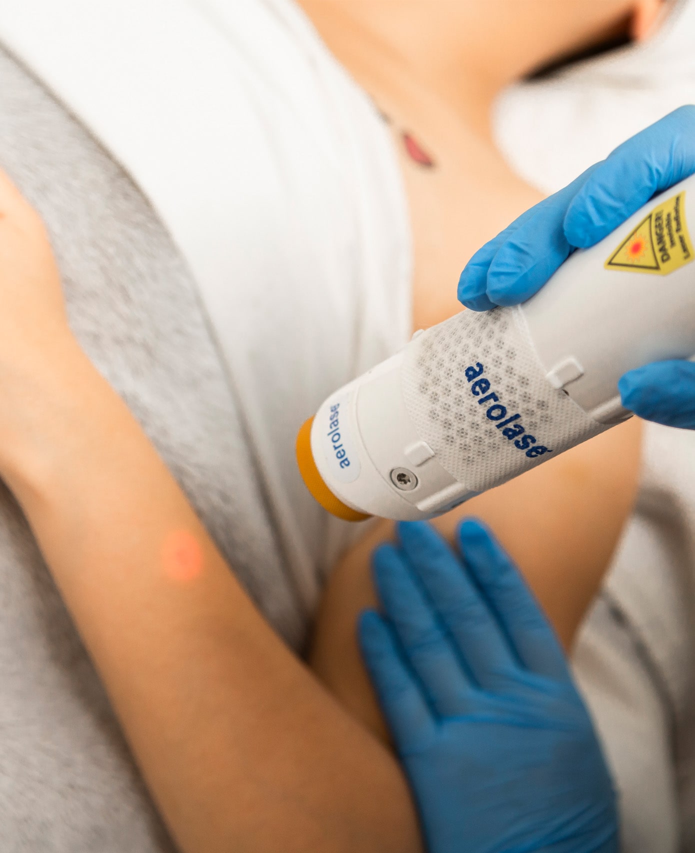 Laser Treatments in Markham, ON | Senzu Bean