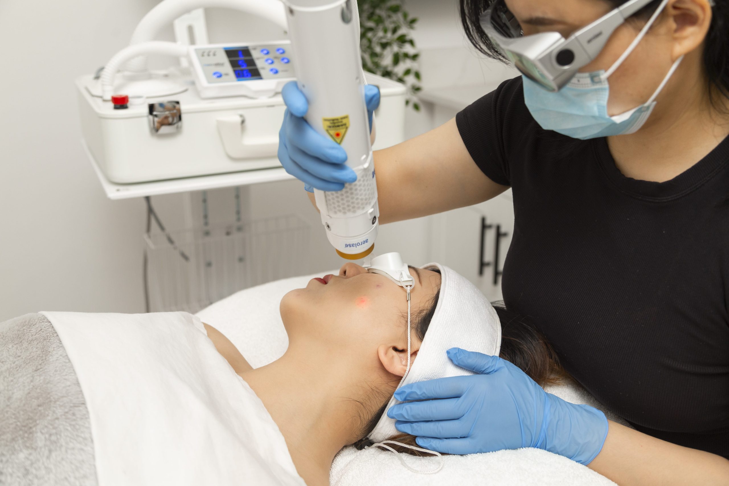 Laser Treatments | Senzu Bean in Markham, ON