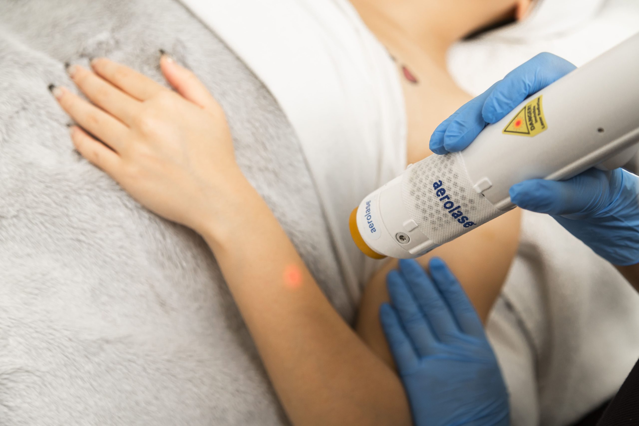 Laser Treatments | Senzu Bean in Markham, ON